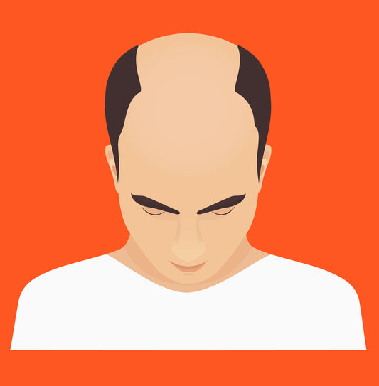 Does a Hair Transplant Look Natural? The Ultimate Guide to Natural-Looking Results