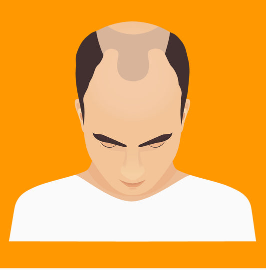 Preparing for a Hair Transplant: Essential Pre-Procedure Checklist