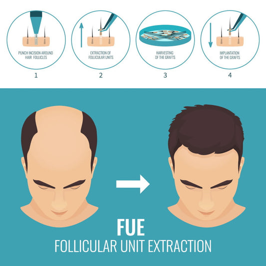 How Age, Genetics, and Lifestyle Affect Hair Transplant Results