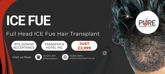 Male Celebrities Who Had Hair Transplantation: Transformations That Inspire Confidence