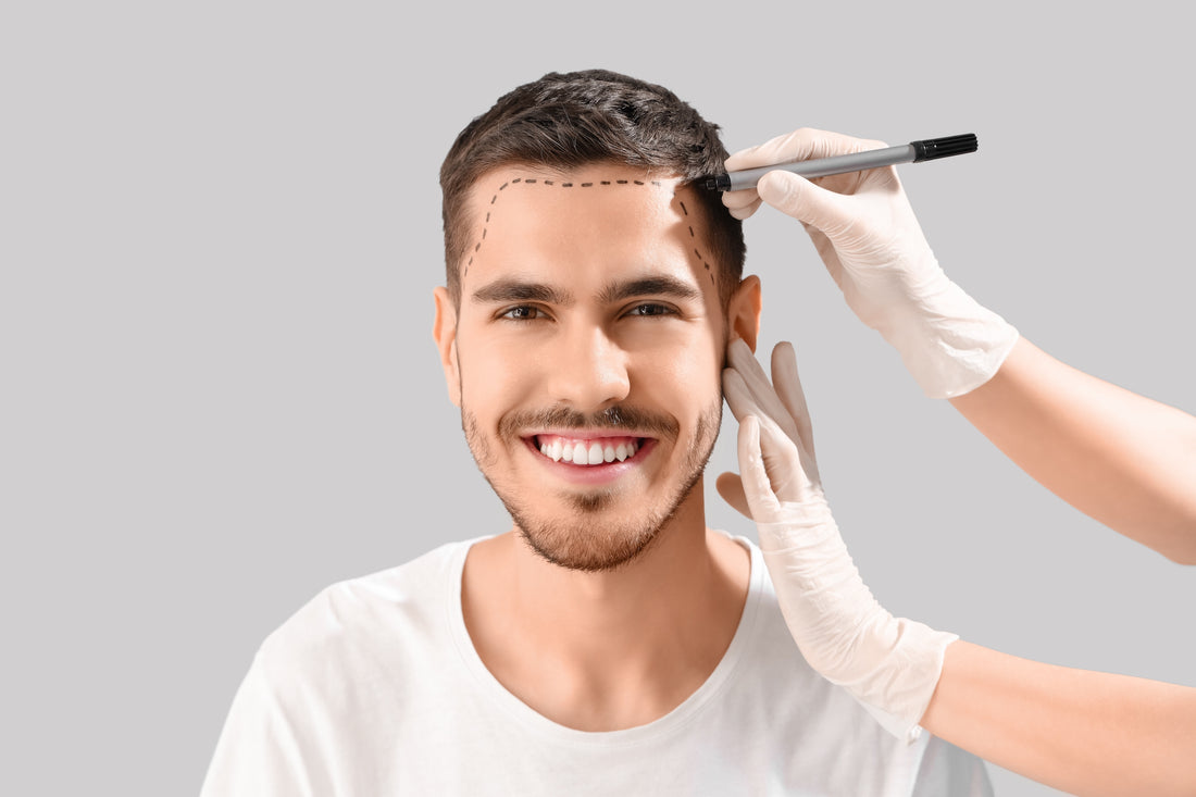 Hairline Design in Hair Transplants: The Art and Science of Achieving a Natural Look